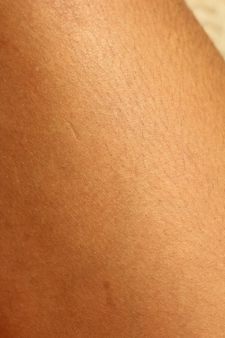 Detalle de la textura de la piel
